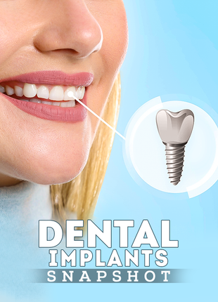 Dental Implants Snapshot